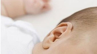 先天性单耳瘘管怎么治疗