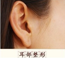小耳畸形有哪几种类型