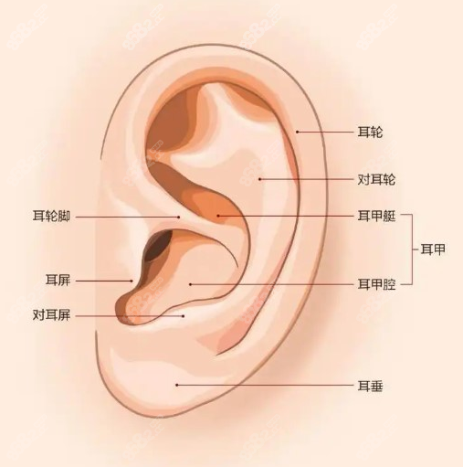 杯状耳整形方法有哪些