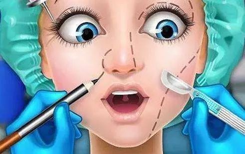 硅胶假体鼻修复