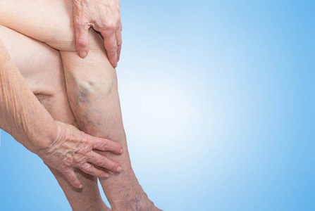 老烂腿溃疡怎么治疗