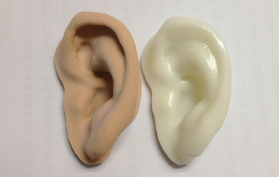 小耳畸形听力重建多少钱