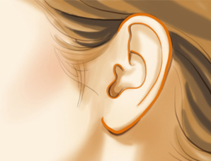 耳朵小耳畸形手术效果