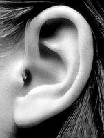 先天性耳瘘手术费用