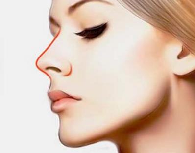 硅胶鼻修复手术难度