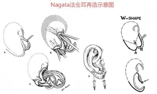 耳廓畸形能检查出来吗