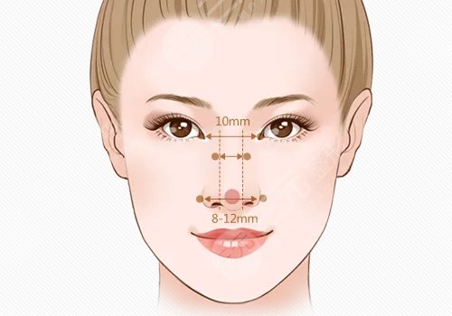 鼻基底填充哪里做得好