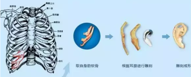 耳瘘是先天性疾病吗