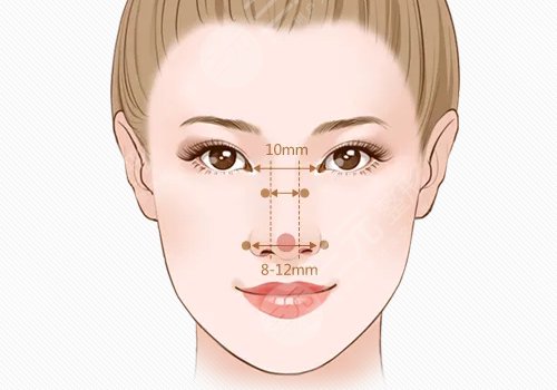 鼻假体取出变形