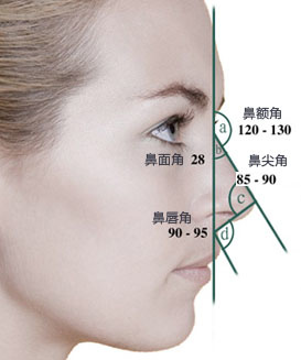 L型假体隆鼻多久定型